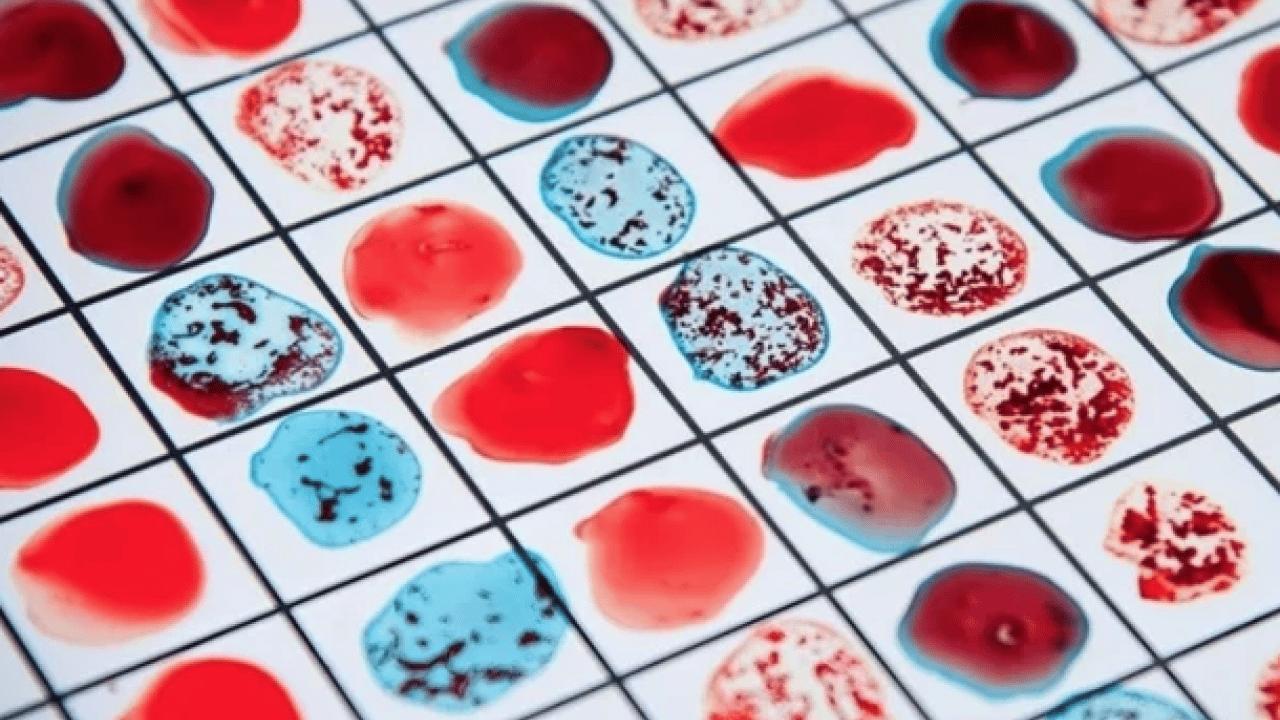 Foto - Düşük kalp hastalığı... Kalbi en kuvvetli kan grubu! Onlar kardiyoloğa uğramıyor