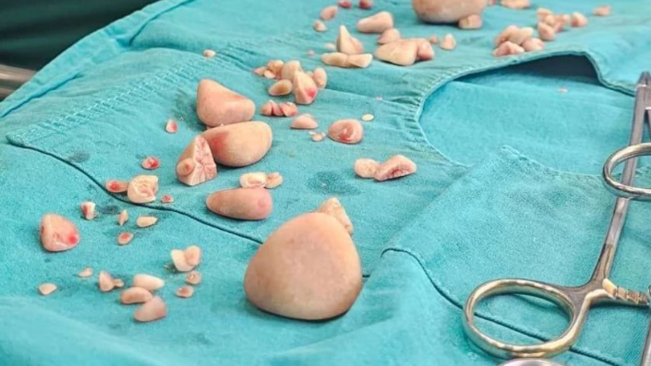 Foto - Duyanlar şaşkına döndü! ‘Tarçın'ın karnından çıkan taş sayısı şoke etti