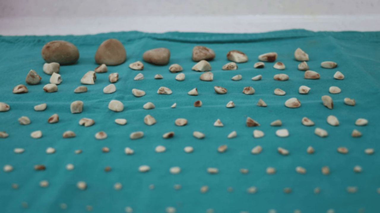 Foto - Duyanlar şaşkına döndü! ‘Tarçın'ın karnından çıkan taş sayısı şoke etti