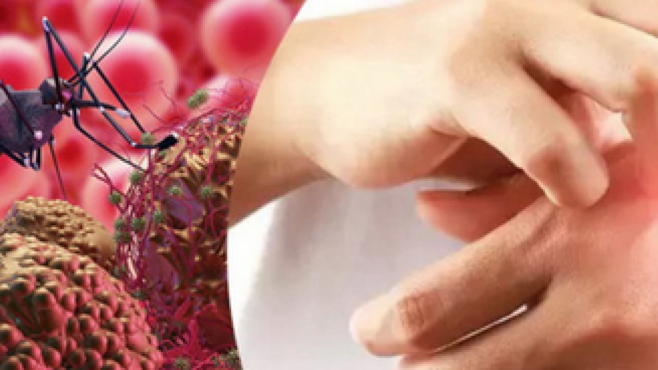 Foto - Ebola, Hantavirüs, Kovid-19 ve M çiçeği (mpox) maalesef artıyor! Bilim insanları tüm dünyaya duyurdu