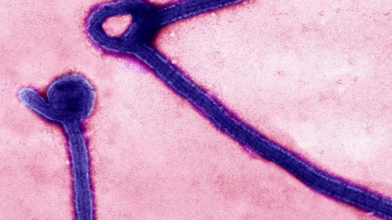 Foto - Ebola korkusu büyüyor: Can kaybı 130’u geçti! ABD’den Kovid sonrası ilk yasa hamlesi