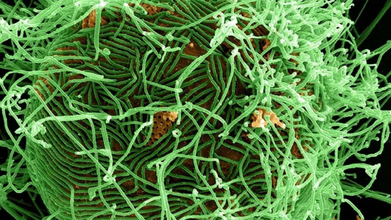 Foto - Ebola korkusu büyüyor: Can kaybı 130’u geçti! ABD’den Kovid sonrası ilk yasa hamlesi