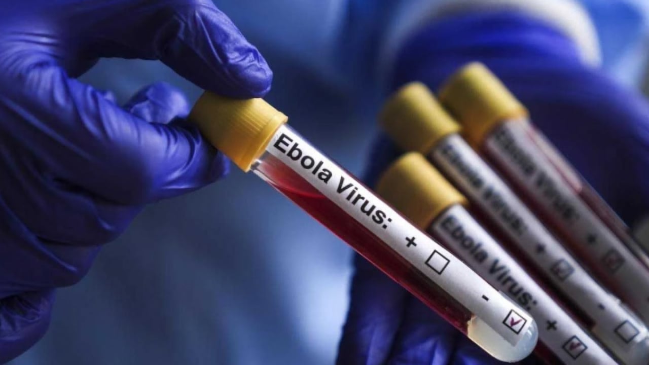Foto - Ebola tehdidi büyüyor! DSÖ’den kritik açıklama