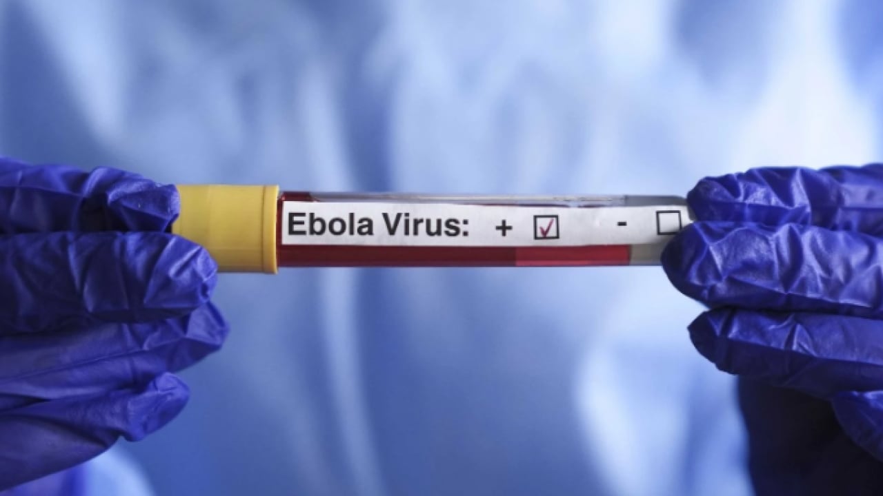 Foto - Ebola tehdidi büyüyor! DSÖ’den kritik açıklama