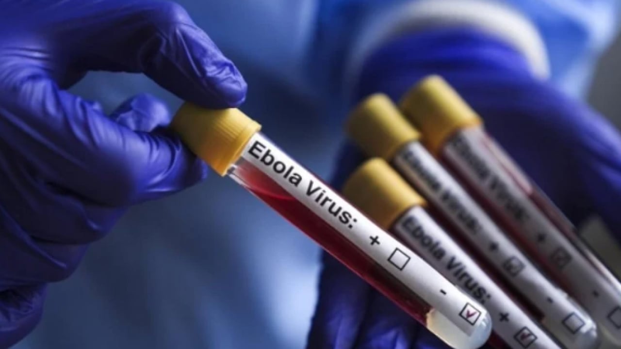 Foto - Ebola'ya karşı tarihi adım: Yeni nesil aşı insanda denendi