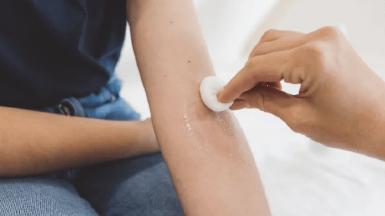 Foto - Egzama derdiniz mi var? Kuyruk yağı kremi egzama tedavisinde sorun oluşturabilir uyarısı...