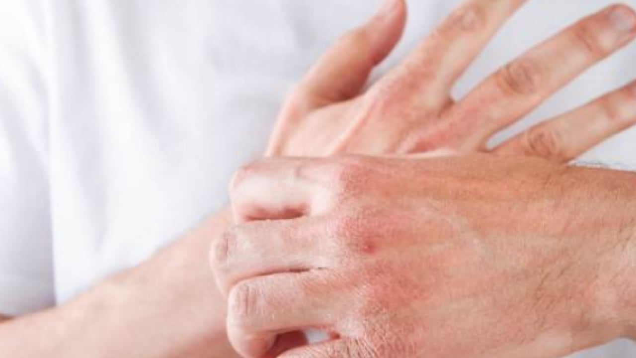 Foto - Egzamadan kurtaran en iyi doğal tedavi olacak: Çarpıcı yolu şaşırttı, görenleri hayrete düşürdü! Bakın nasıl yapılıyor