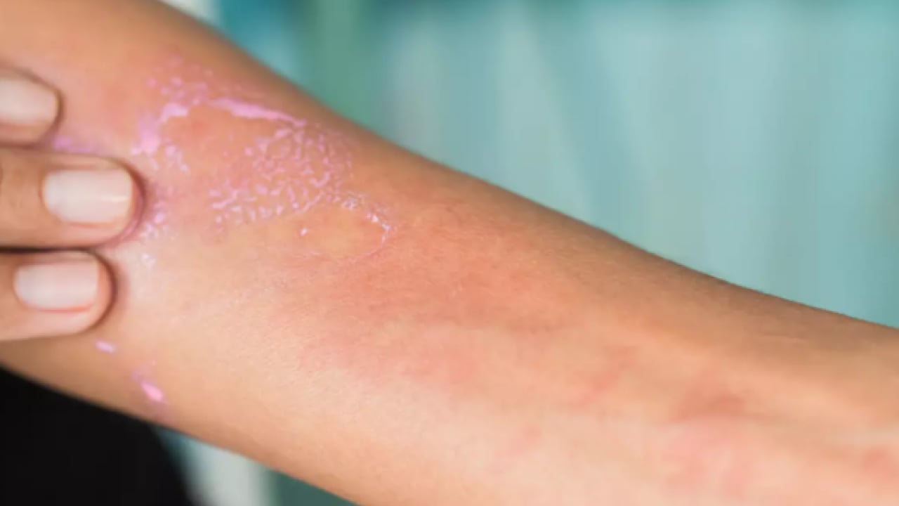 Foto - Egzamaya iyi geliyor diye sürülüyor: Meğer cilde çok zarar veriyormuş!