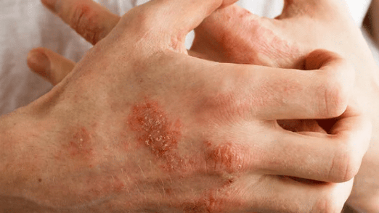 Foto - Egzamaya iyi geliyor diye sürülüyor: Meğer cilde çok zarar veriyormuş!