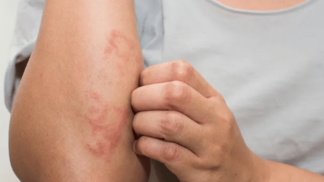 Foto - Egzamaya iyi geliyor diye sürülüyor: Meğer cilde çok zarar veriyormuş!