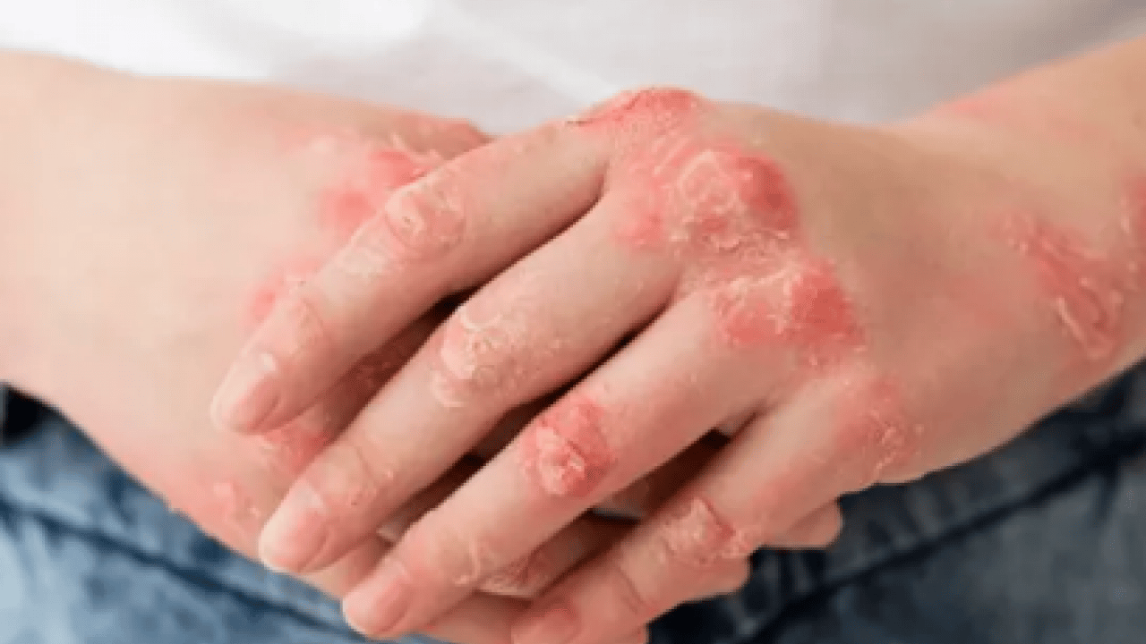 Foto - Egzamaya iyi geliyor diye sürülüyor: Meğer cilde çok zarar veriyormuş!