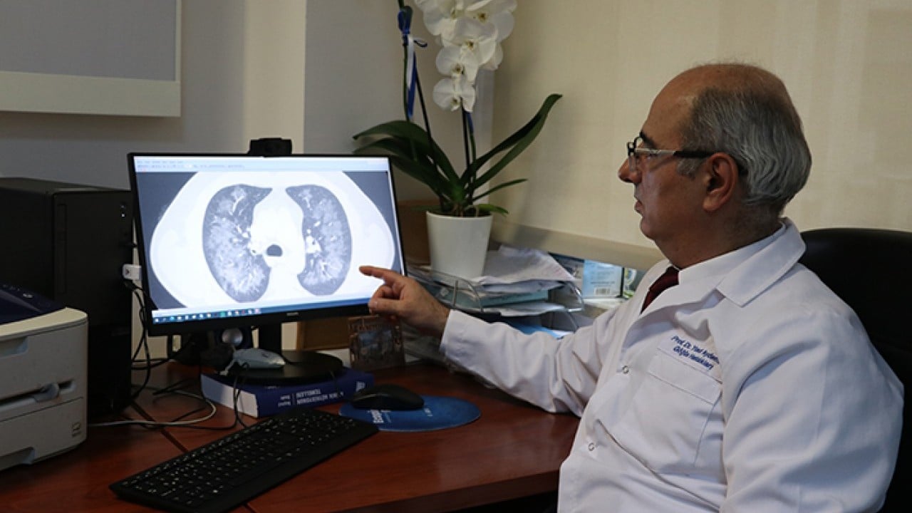 Foto - Elektronik sigara son durak yoğun bakım!