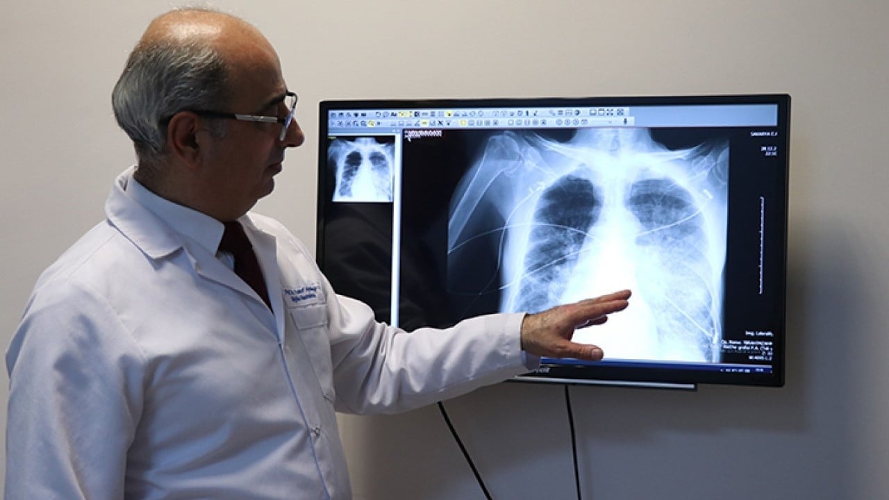 Foto - Elektronik sigara son durak yoğun bakım!