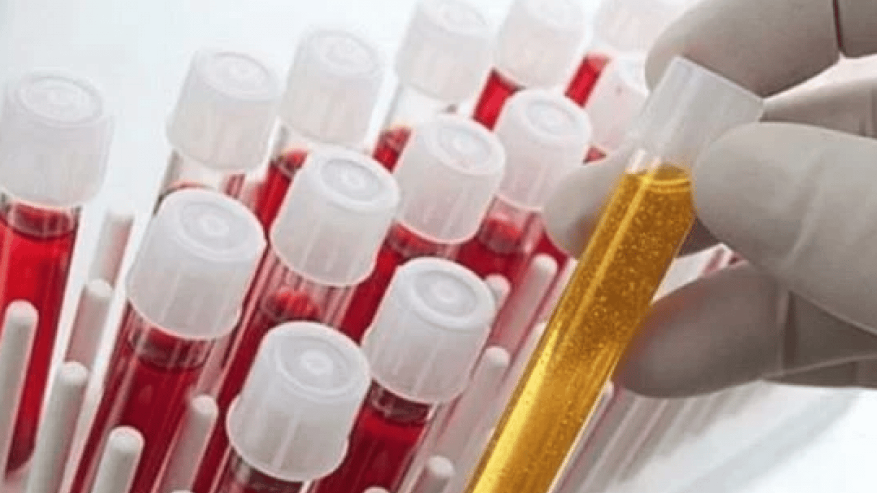 Foto - En güçlü bağışıklık hangi kan grubunda? Gerçekler şaşırtıyor... Doğru kabul edilmiyor