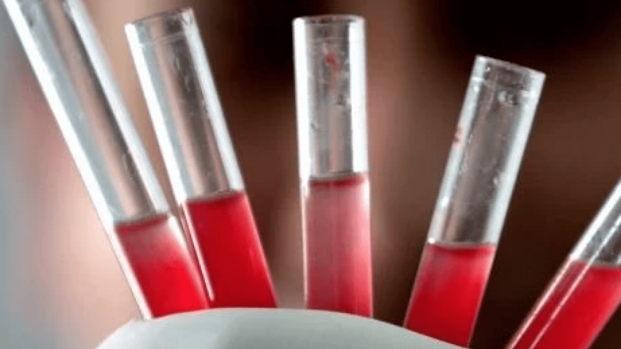 Foto - En güçlü bağışıklık hangi kan grubunda? Gerçekler şaşırtıyor... Doğru kabul edilmiyor