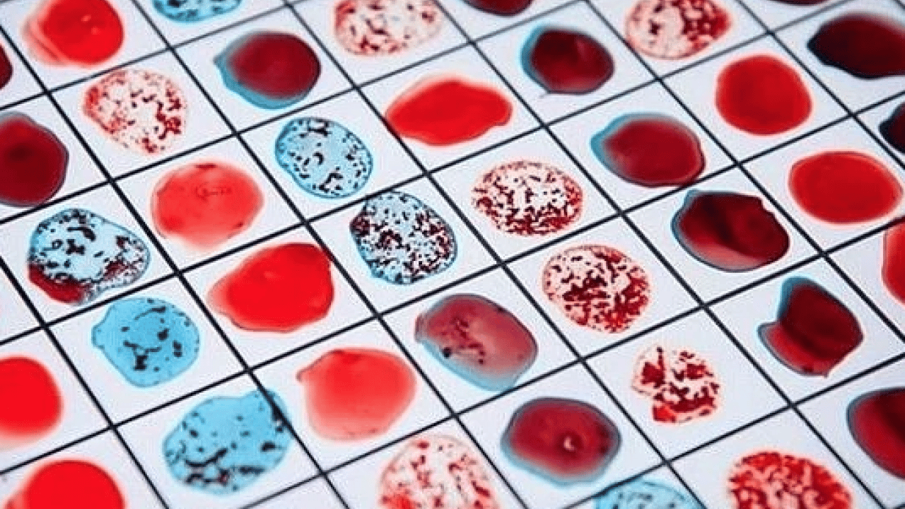 Foto - En güçlü bağışıklık hangi kan grubunda? Gerçekler şaşırtıyor... Doğru kabul edilmiyor