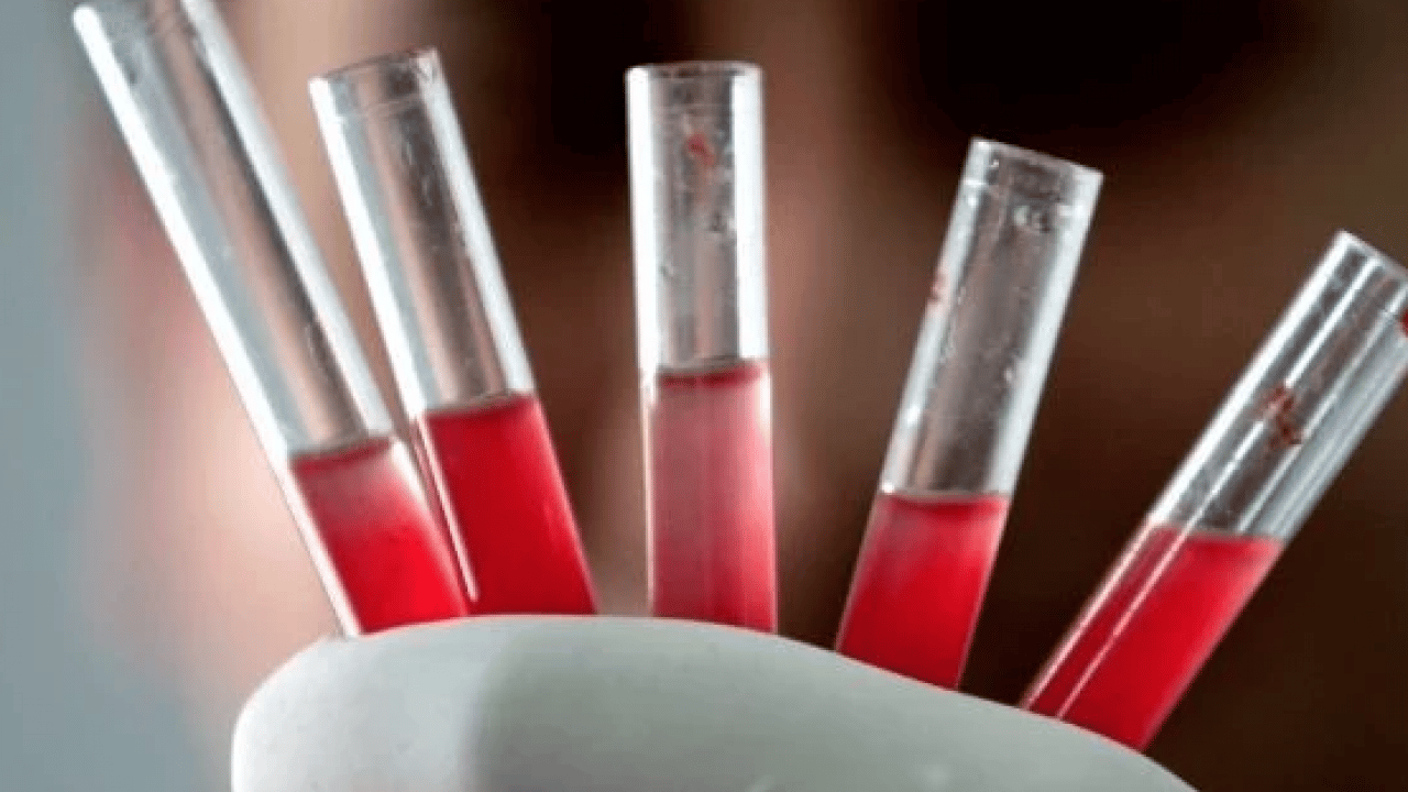 Foto - En güçlü bağışıklık hangi kan grubunda? Gerçekler şaşırtıyor... Doğru kabul edilmiyor