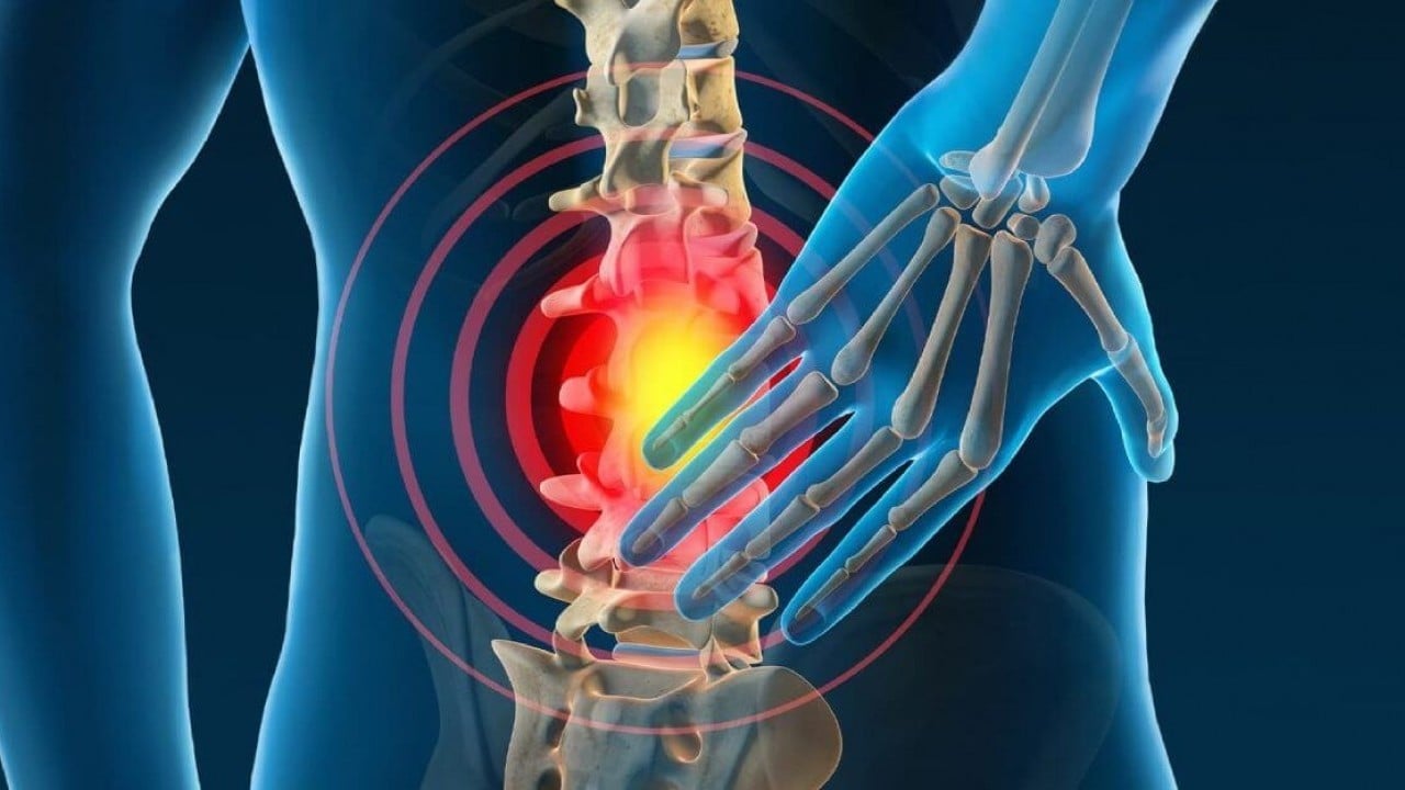 Foto - En yaygın ikinci rahatsızlık: Bel ağrısından korunmanın 10 altın kuralı