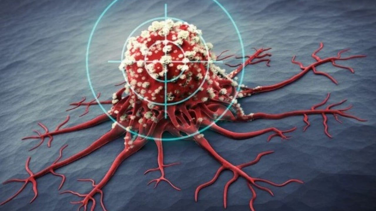 Foto - Enfeksiyon sandı ama bakın ne çıktı! Bu belirti varsa hemen hastaneye gidin