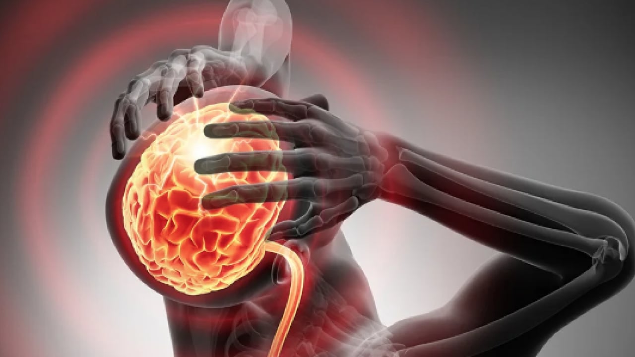 Foto - Epileptik nöbet, güçsüzlük, konuşma bozukluğu... Beyin tümörleri ilk habercisi!