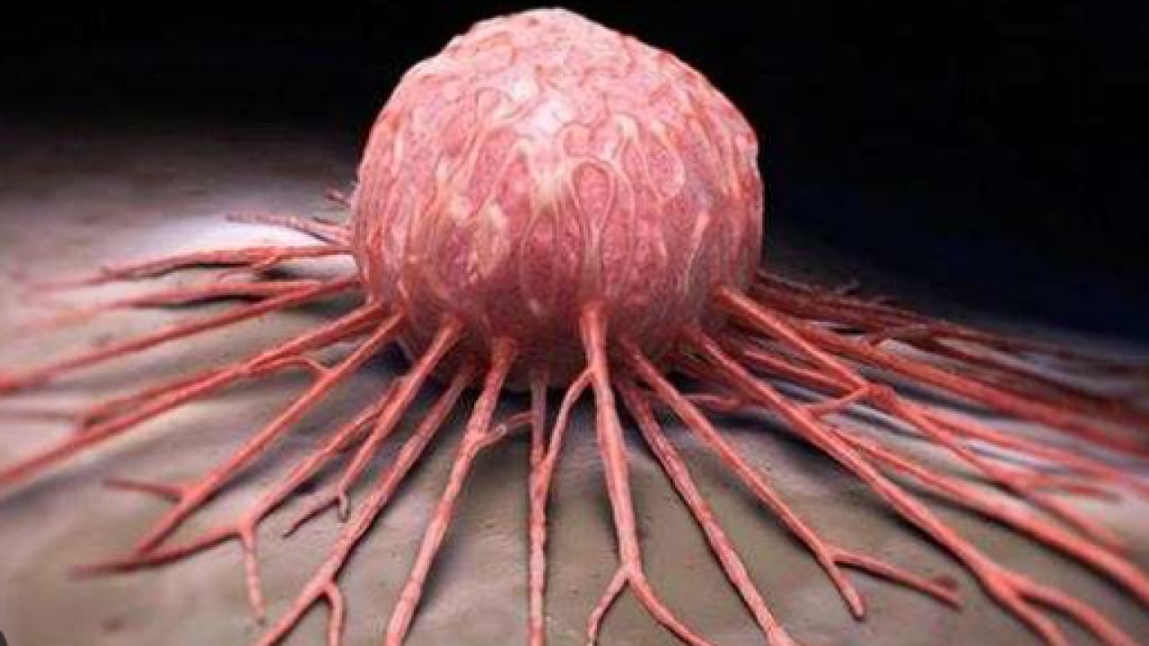 Foto - Erkek ve kadınları bekleyen ortak tehlike: Korkutan kanser uyarısı! 