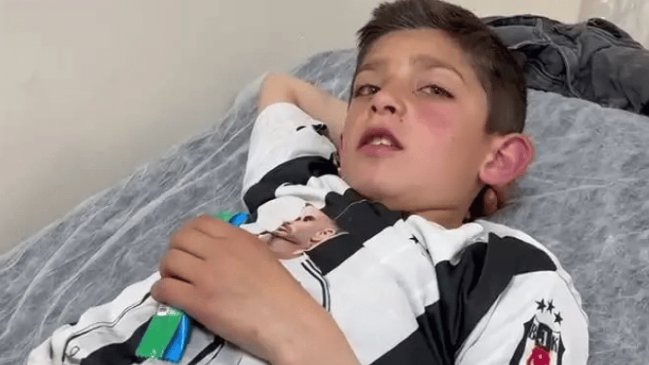 Foto - 10 yaşındaki çocuk 2 ayının saldırısına uğradı! Nasıl kurtulduğunu anlattı!