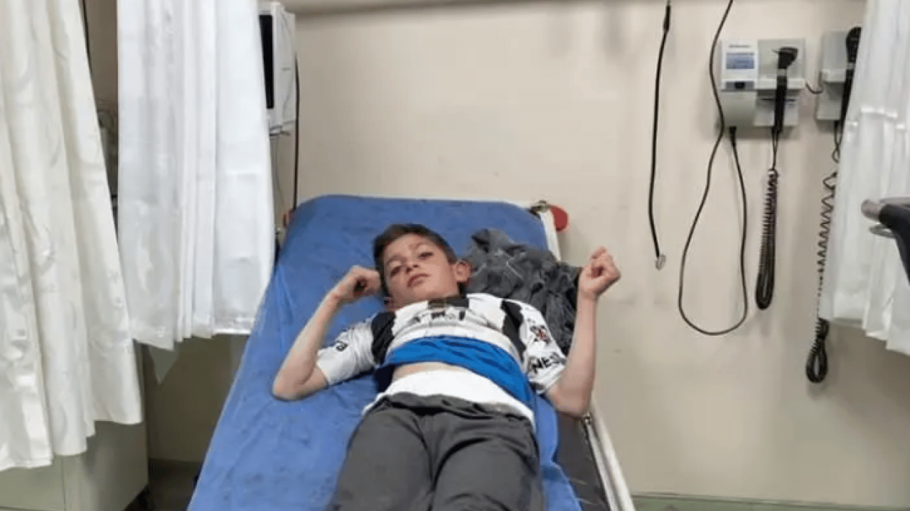 10 yaşındaki çocuk 2 ayının saldırısına uğradı! Nasıl kurtulduğunu anlattı!