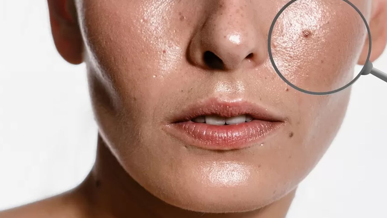 Foto - Et benlerini patır patır düşüren gizli kür tarifi Prof. Dr. İbrahim Saraçoğlu verdi: Haftada 2 kez kullanın diyor, önerisi bu