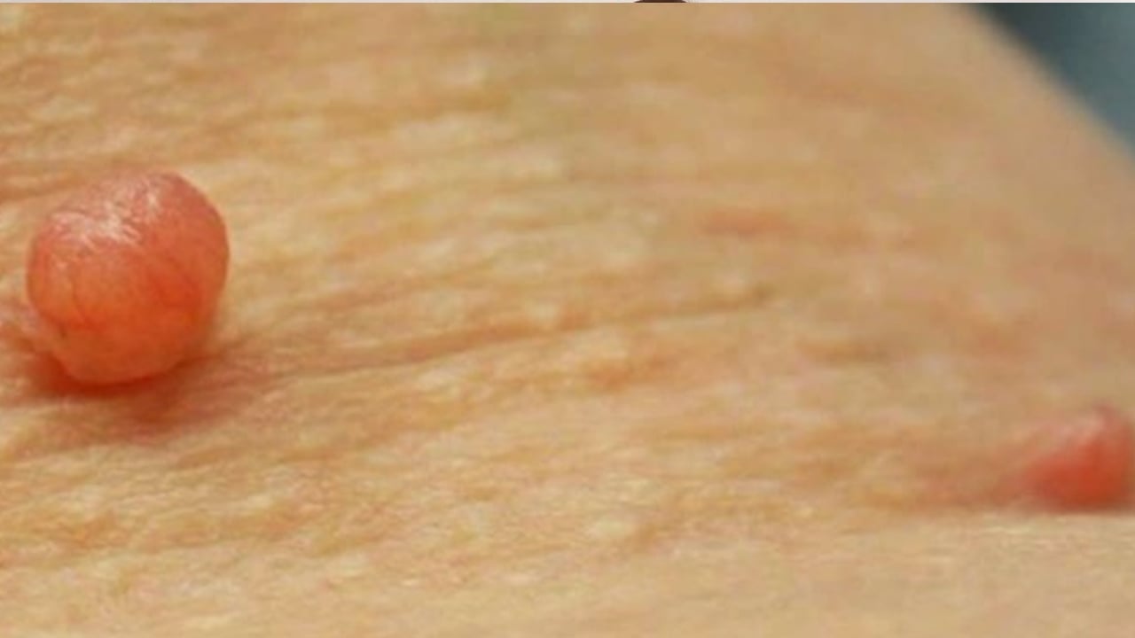 Foto - Et benlerini patır patır düşüren gizli kür tarifi Prof. Dr. İbrahim Saraçoğlu verdi: Haftada 2 kez kullanın diyor, önerisi bu