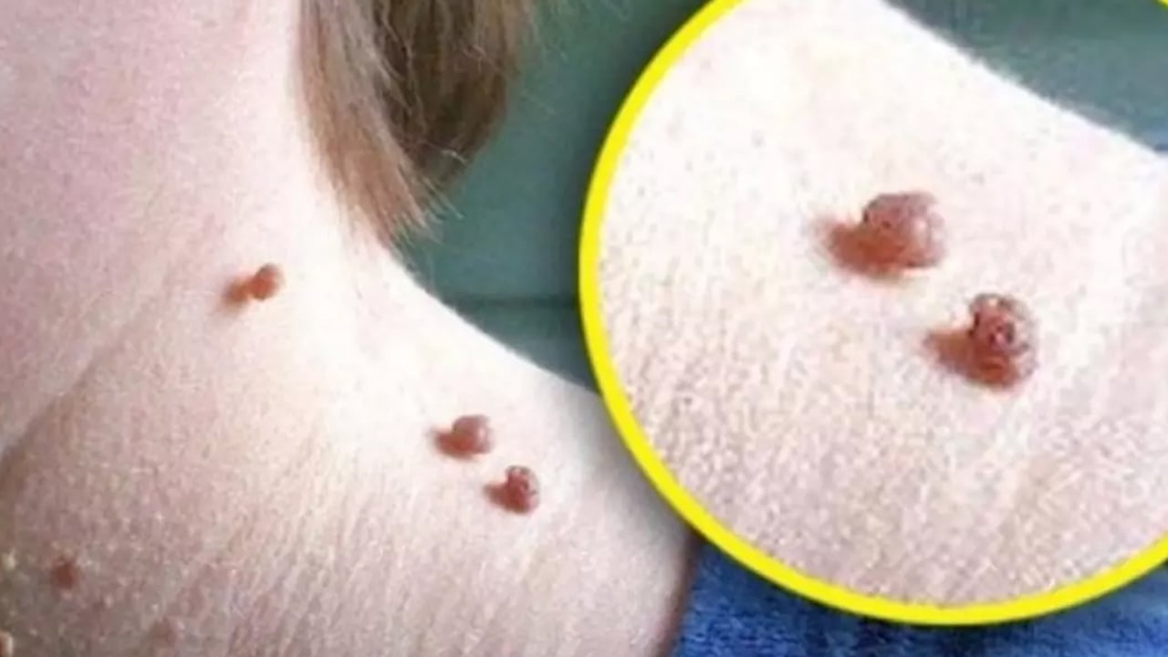 Foto - Et benlerini patır patır düşüren gizli kür tarifi Prof. Dr. İbrahim Saraçoğlu verdi: Haftada 2 kez kullanın diyor, önerisi bu