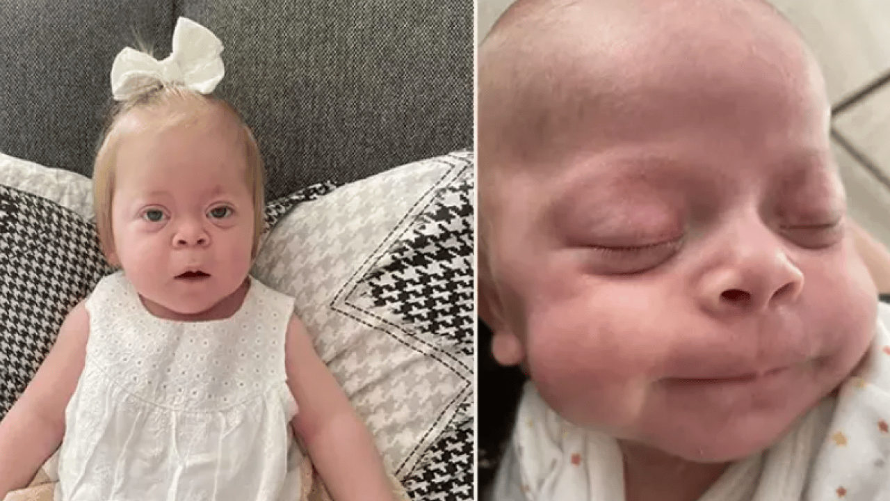 Foto - Evlada ölümcül tanı, aileye taşıyıcı şoku! Tedavisi olmadığı öğrenildi