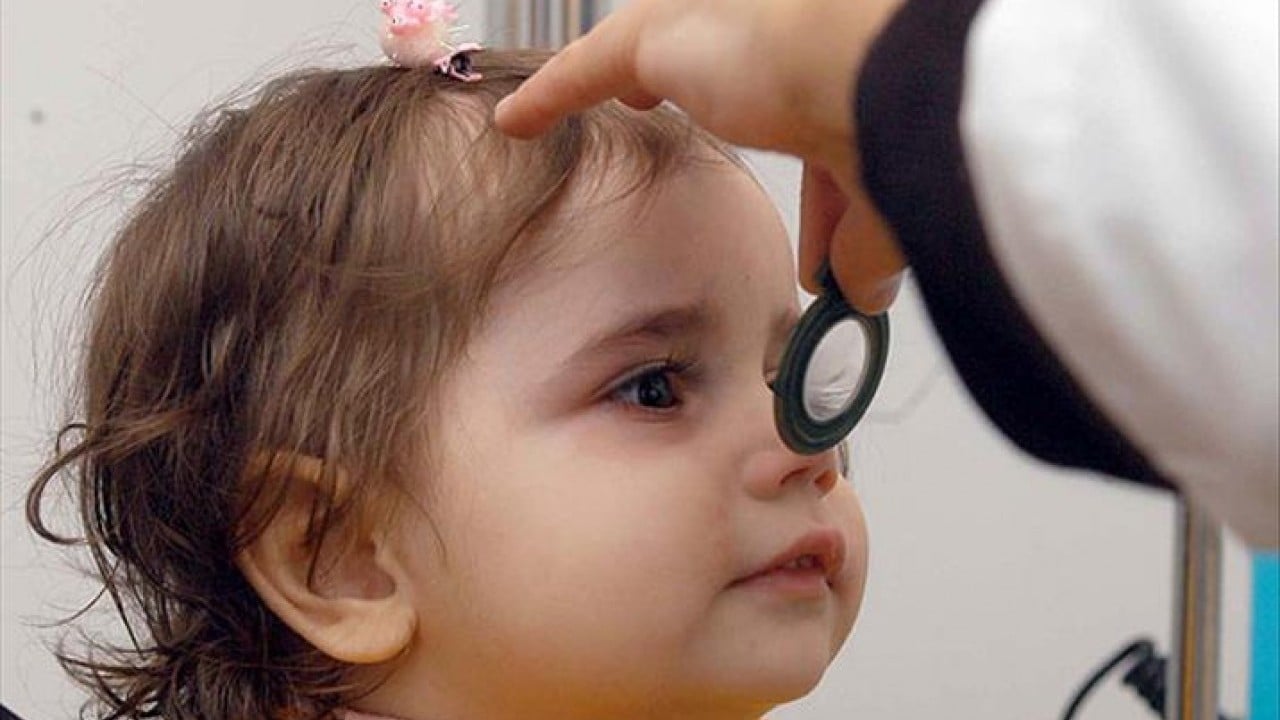 Foto - Fark edilmeyen katarakt tehlikesi! İleri yaşta görme kaybına yol açabiliyor