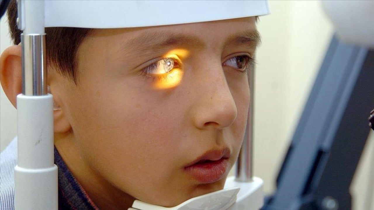 Foto - Fark edilmeyen katarakt tehlikesi! İleri yaşta görme kaybına yol açabiliyor