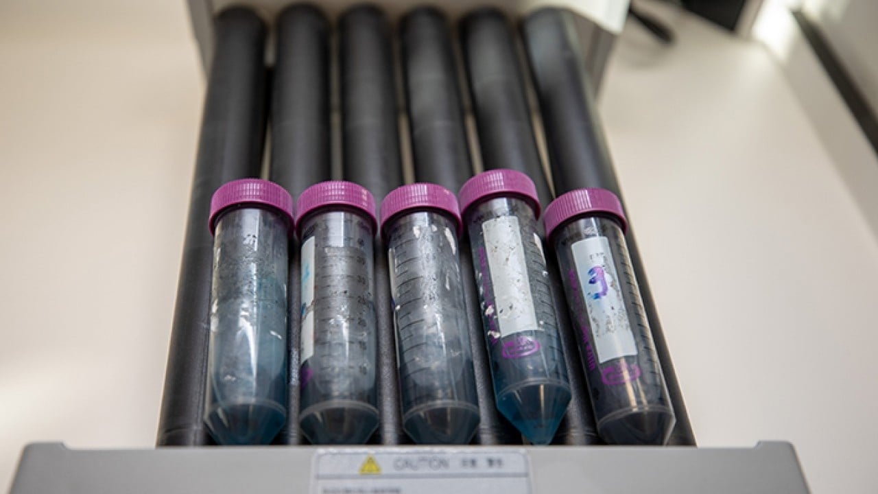 Foto - Fındık kabuğundan aktif karbon