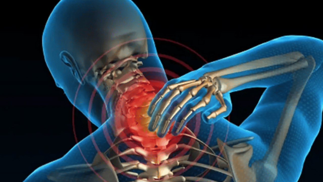 Foto - Flaş açıklamalara kulak verelim: Boyun fıtığı kırmızı alarm veriyor... Uzmanlar anlattı