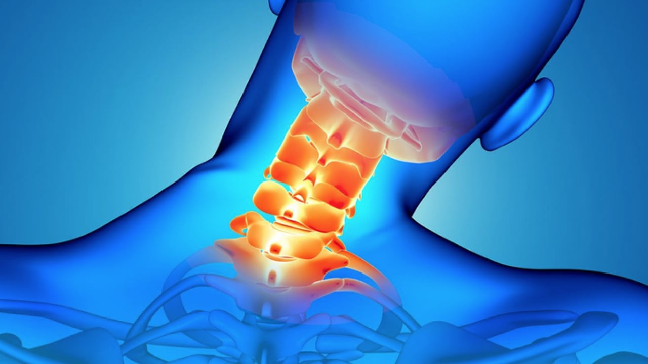 Foto - Flaş açıklamalara kulak verelim: Boyun fıtığı kırmızı alarm veriyor... Uzmanlar anlattı