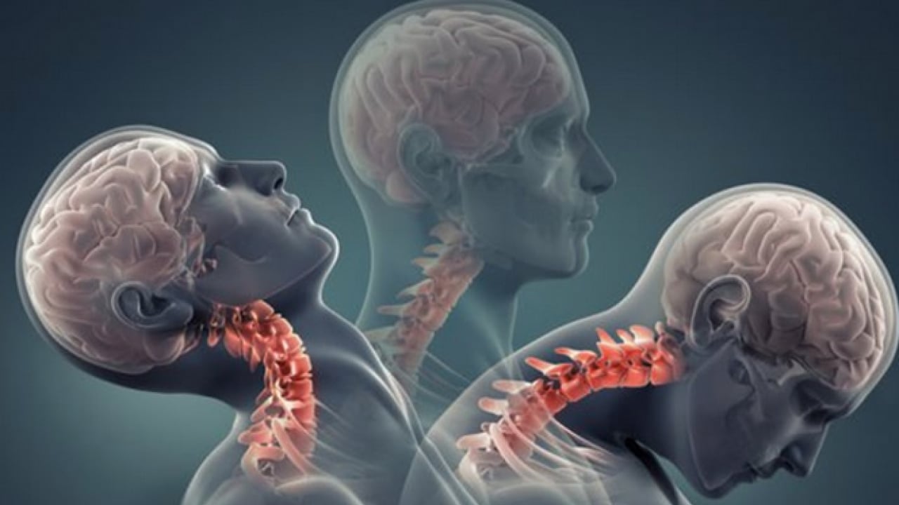 Foto - Flaş açıklamalara kulak verelim: Boyun fıtığı kırmızı alarm veriyor... Uzmanlar anlattı