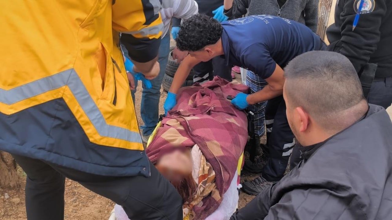 Foto - Foseptik çukuruna düşen genç kız canından oluyordu 