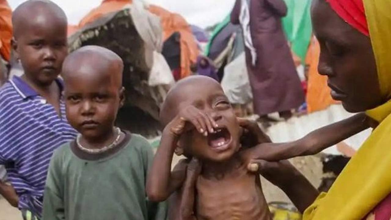 Foto - Gazze gibi Sudan da yalnız bırakıldı… Bir ayda 23 çocuk açlıktan öldü