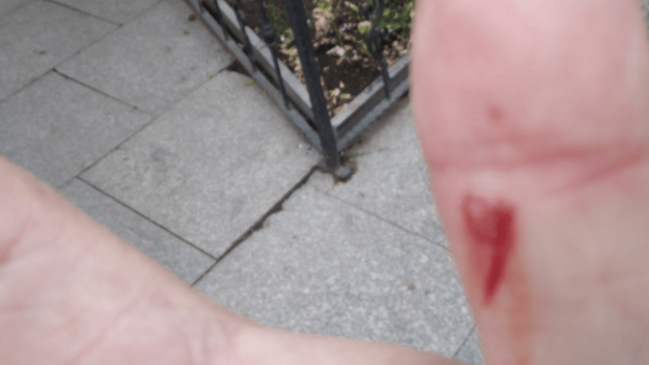 Foto - Gazze için düzenlenen etkinliği haber yapan gazeteciye CHP’li Çorlu Belediyesi personeli saldırdı