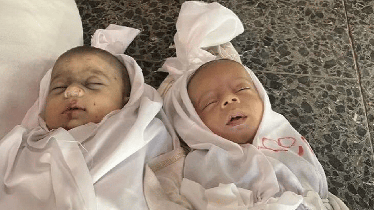 Foto - Gazze'de binlerce çocuk Nasır Hastanesi'de tedavi bekliyor: Birçok 'Batılı gazeteci'den sert eleştiri geldi