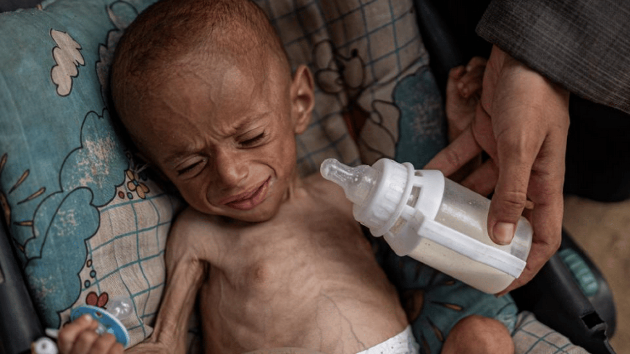 Foto - Gazze'de binlerce çocuk Nasır Hastanesi'de tedavi bekliyor: Birçok 'Batılı gazeteci'den sert eleştiri geldi