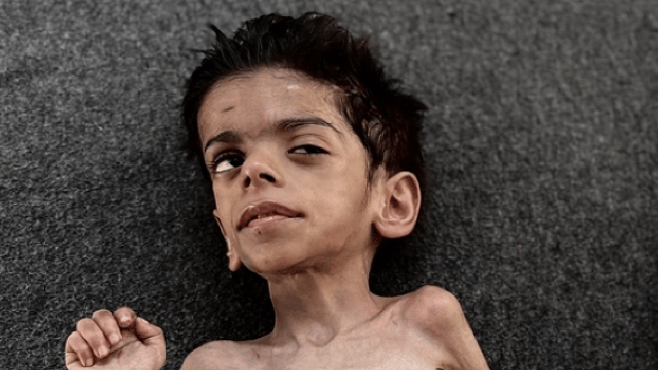 Foto - Gazze'de binlerce çocuk Nasır Hastanesi'de tedavi bekliyor: Birçok 'Batılı gazeteci'den sert eleştiri geldi