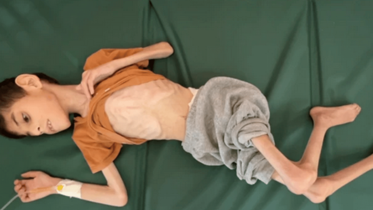 Foto - Gazze'de binlerce çocuk Nasır Hastanesi'de tedavi bekliyor: Birçok 'Batılı gazeteci'den sert eleştiri geldi