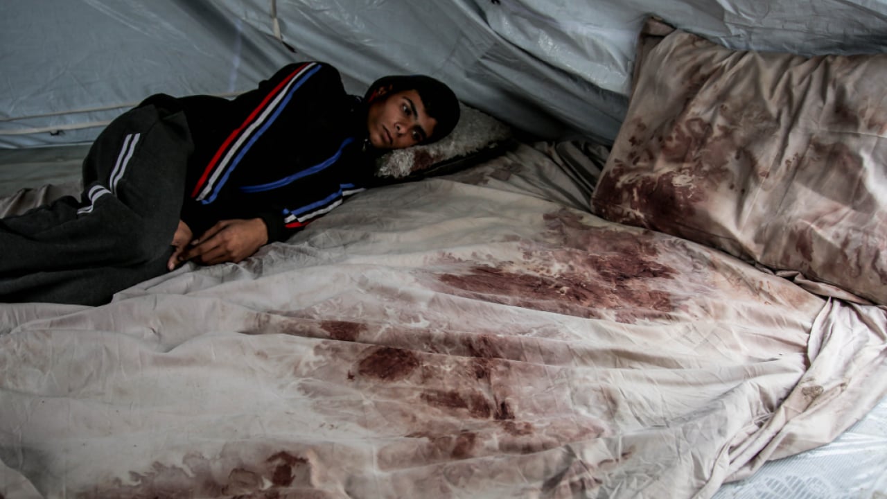 Foto - Gazze'deki soykırımın görünmeyen kurbanı! Evlendikten iki gün sonra eşini kaybetti