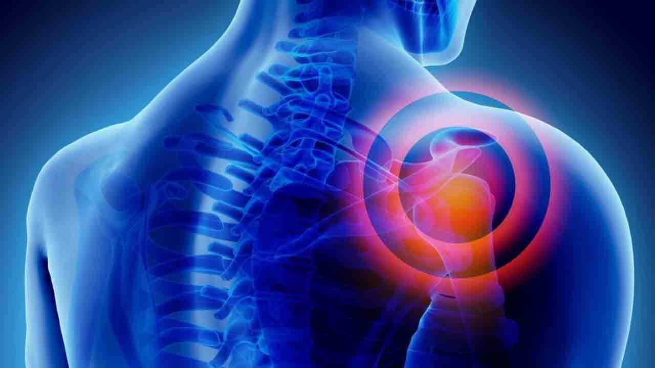 Foto - Geceleri başlayan omuz ağrısına dikkat: Donuk omuz sessizce hayatı kilitliyor