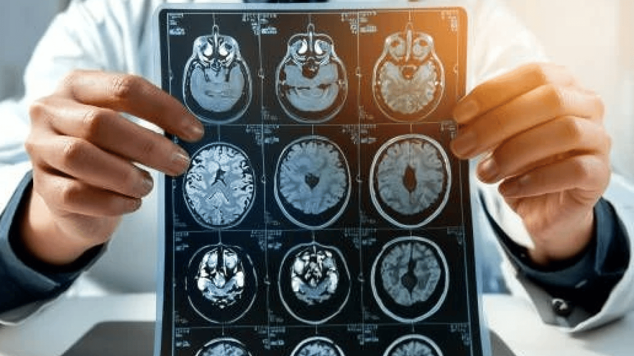 Foto - Geçmeyen baş dönmesine dikkat! Bakın hangi hastalıkların belirtisi