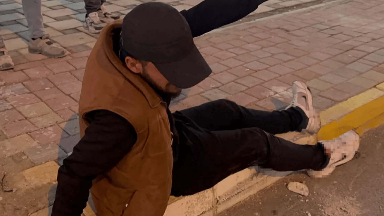 Foto - Genç adam sokakta yürürken bıçaklandı! Nedeni pes dedirtti!