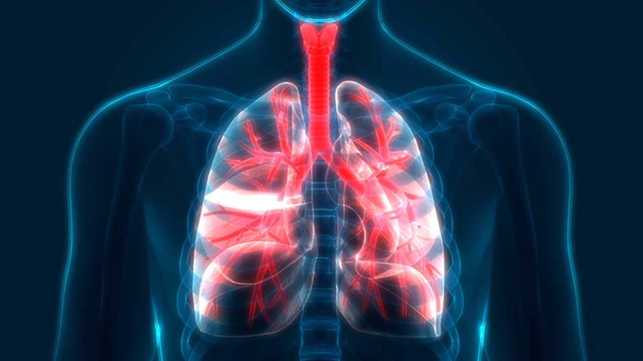 Foto - Gençlerin kas ağrısı dediği o sızı ölümcül akciğer sönmesi olabilir! Belirtileri hafife alanları bekleyen büyük tehlike gün yüzüne çıktı
