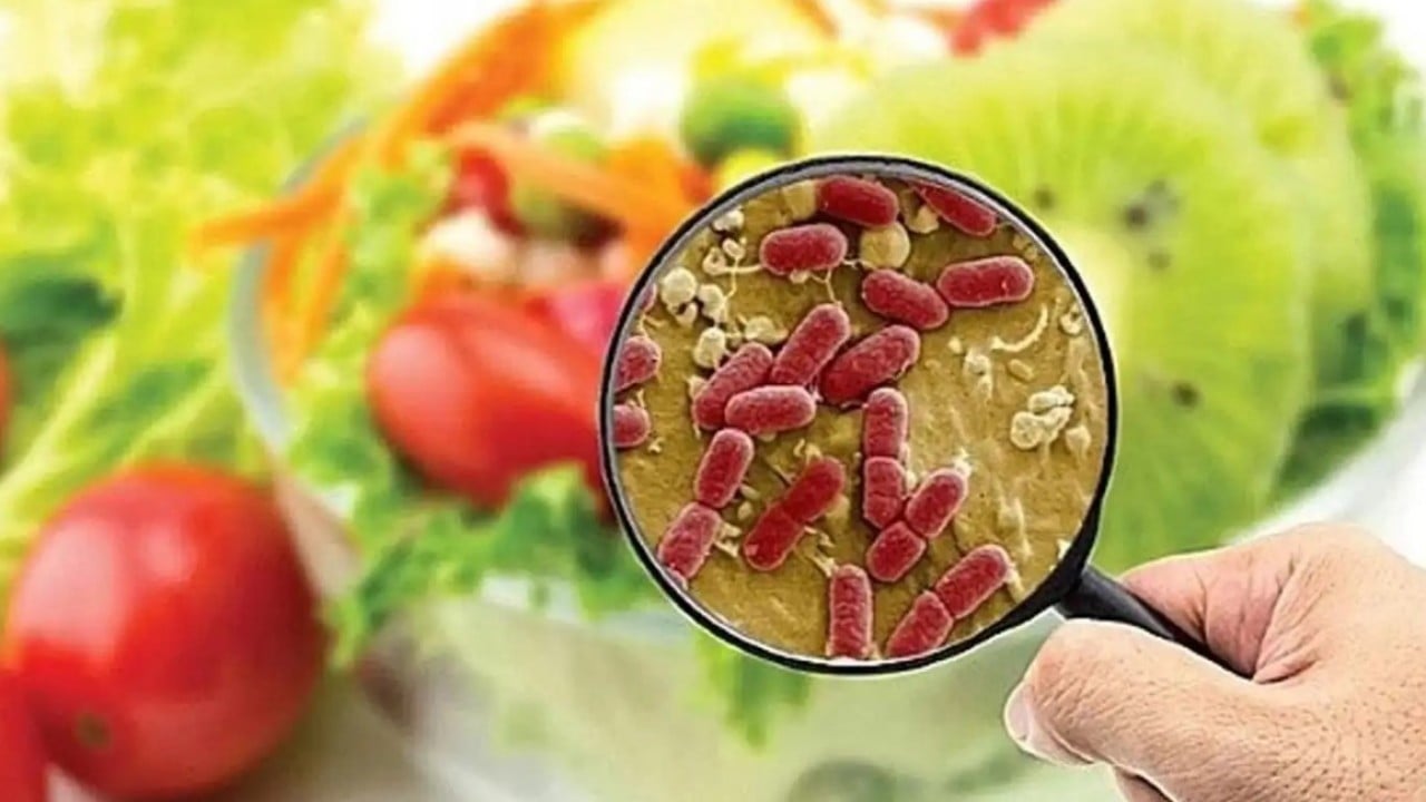 Foto - Gıda zehirlenmesi belirtileri neler? İşte en sık karşılaşılan nedenler